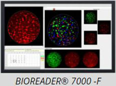荧光酶联免疫斑点分析仪，elispot检测分析系统，德国bioreader 7000-f elispot读取仪